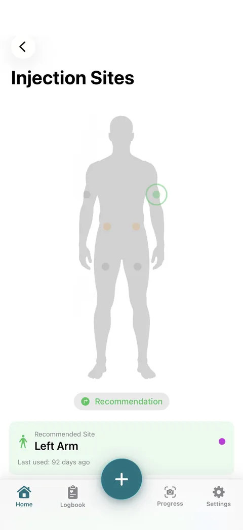 Injection site rotation